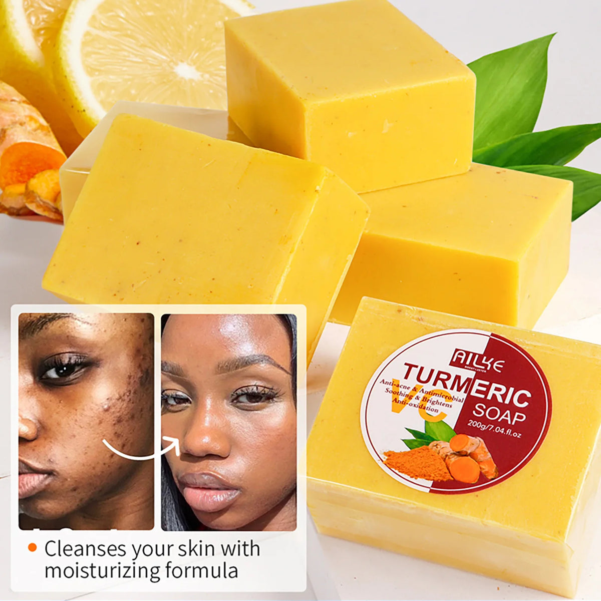 Radiant Skin Turmeric Skincare Collection
