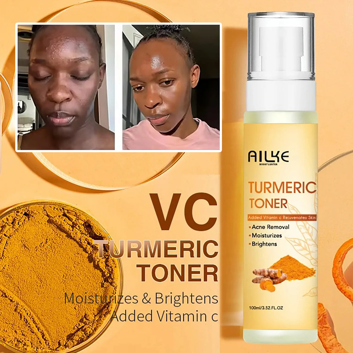 Radiant Skin Turmeric Skincare Collection