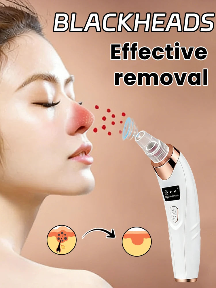 Radiance Pro Blackhead Remover