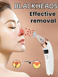 Radiance Pro Blackhead Remover