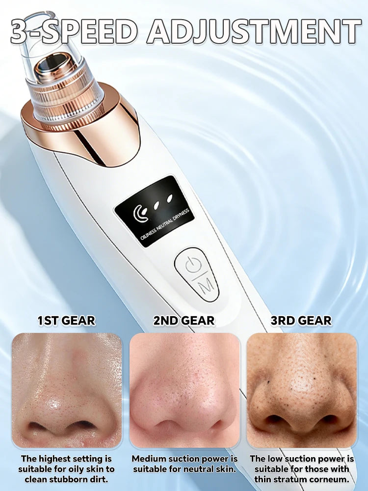Radiance Pro Blackhead Remover