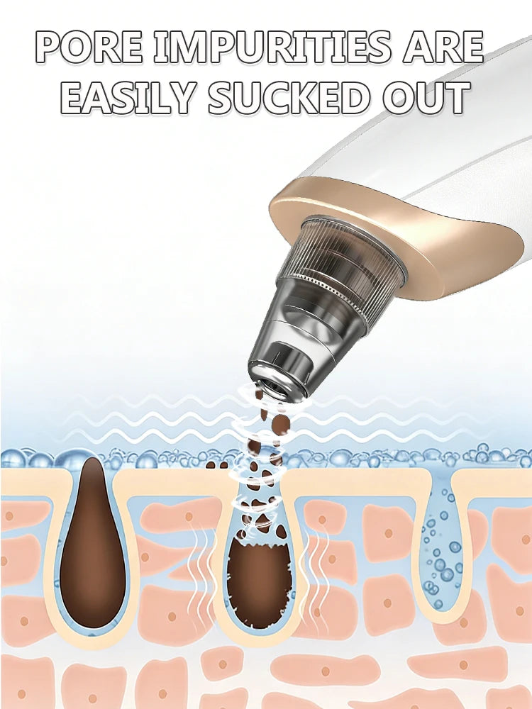 Radiance Pro Blackhead Remover